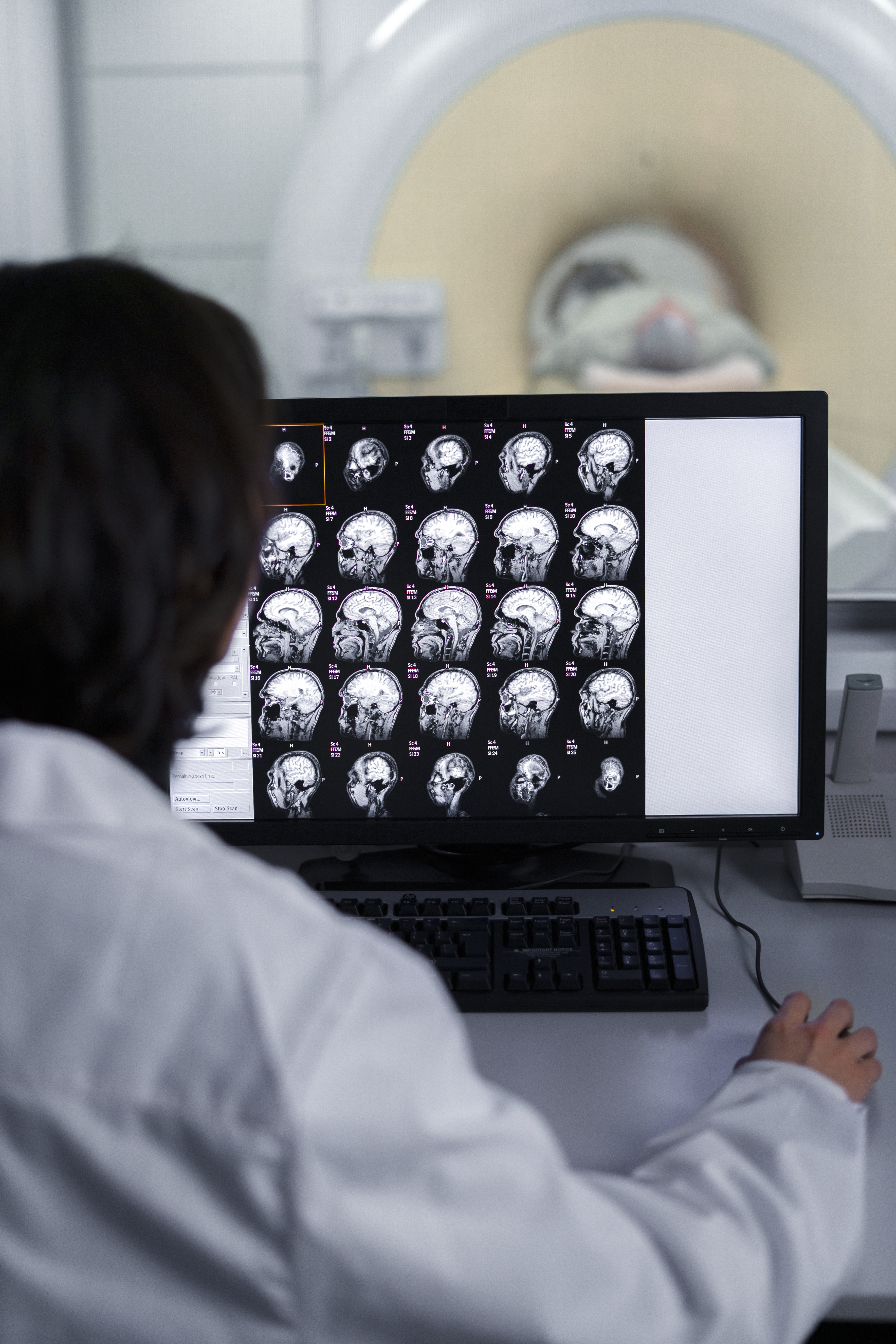 Neurology